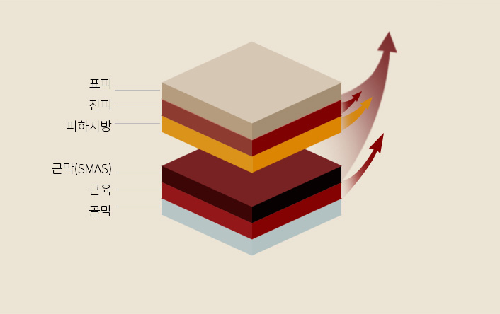 허쉬성형외과 맥스리프팅