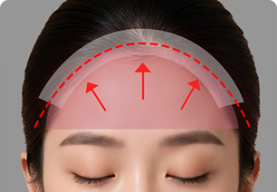 Procedure