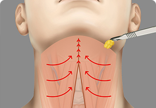 Procedure