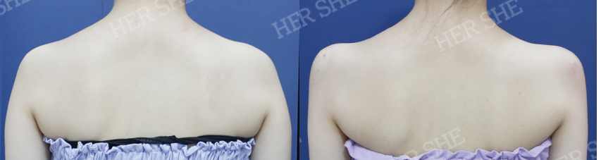 BEFORE & AFTER