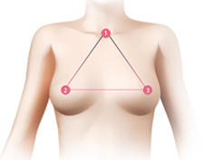 Информация о пластической хирургии груди